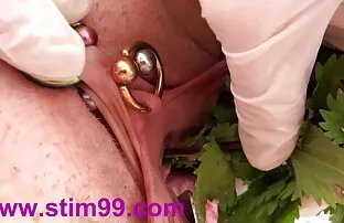 बिच्छी बिच्छी र भिल्वामा मूत्रमार्गको anastomosis