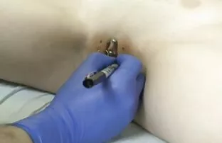 छेड्ने १