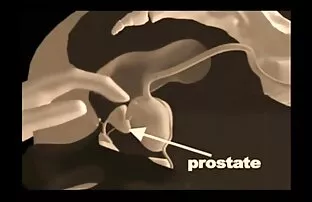 प्रोस्टेट मसाज प्रविधि