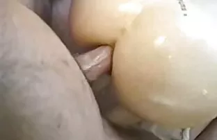 गुदा स्क्वर्ट