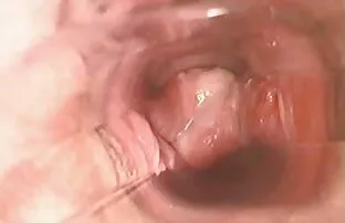 Orgasm l7 को बखत भित्र भित्र